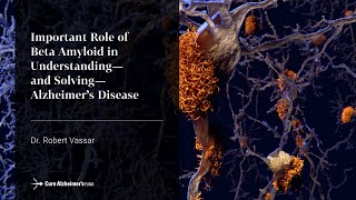 Important Role of Beta Amyloid to Alzheimers Disease [upl. by Etna]