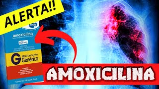 AMOXICILINA 500mg✅✅Alerta sobre a AMOXICILINA 500 mg para que serve Como tomar e Efeitos Colaterais [upl. by Terrej708]