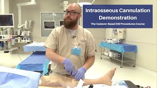 Intraosseous Cannulation Demonstration  The CadaverBased EM Procedures SelfStudy Course [upl. by Llerrut583]