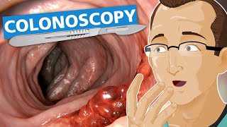 Colonoscopy [upl. by Acul459]