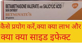 Betnovate S  Betamethasone Valerate amp Salicylic Acid Use Profit and sideeffective in Hindi [upl. by Selle]