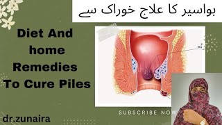 Management and treatment of piles  piles ka ilaj ghar ma  hemorrhoids [upl. by Biddick]