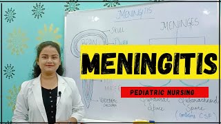 MENINGITIS  MENINGITIS CHILD HEALTH NURSING CAUSES SIGN AND SYMPTOMS MANAGEMENT OF MENINGITIS [upl. by Ahselrak]