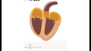 ECG pedia course introduction [upl. by Beshore271]