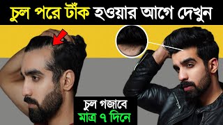 চুল পড়া বন্ধ ও নতুন চুল গজানোর উপায়  How To Grow Hair and Stop Hair Fall  Success Never End [upl. by Hills931]