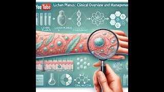 Lichen Planus Clinical Overview and Management [upl. by Ati]