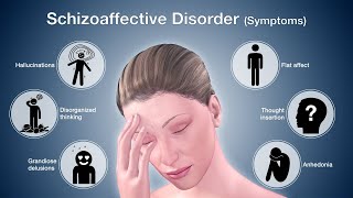 How To Manage Schizoaffective Disorder LIVE QampA w David Sarchet [upl. by Sarah]