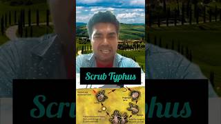 Scrub typhus se kese bache  Scrub typhus kya hai shorts shortsfeed scrubtyphus health [upl. by Aisital]