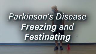 Parkinsons Disease Freezing amp Festinating Gait [upl. by Prue]