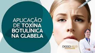 Aplicação de Toxina Botulínica na Glabela [upl. by Rains]