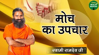 मोच का उपचार  Moch Ka Ilaj  Swami Ramdev Ji  Ayurveda Treatment  Sanskar Health Mantra [upl. by Ilana]