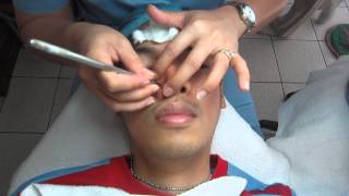 Facial w Diamond Peel amp NonSurgical Face Lift Treatment Part 37 [upl. by Launamme681]