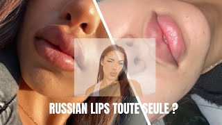 JE FAIS MES INJECTIONS TOUTE SEULE RUSSIAN LIPS [upl. by Florencia]