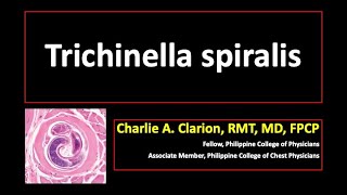 Trichinella spiralis [upl. by Leftwich]