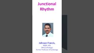 Junctional Rhythm [upl. by Atterehs403]