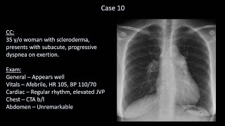 How to Interpret a Chest XRay Lesson 10  Self Assessment Part 2 [upl. by Hesta]