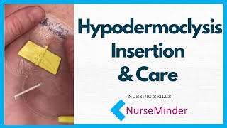 Hypodermoclysis Insertion and Care for Nurses [upl. by Hermy3]