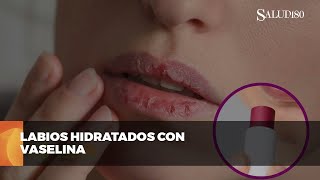 ✅ Protege tus labios del frío  Salud180 🌿 [upl. by Noet]