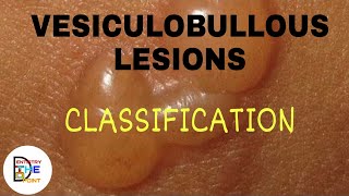 VESICULOBULLOUS LESIONS CLASSIFICATION [upl. by Sitto573]