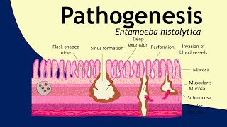 Pathogenesis of Entamoeba histolytica  parasitology  Basic Science Series [upl. by Anahir136]