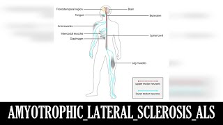 AMYOTROPHIC LATERAL SCLEROSIS ALS [upl. by Shanahan]