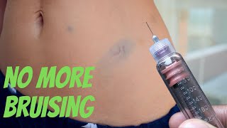 Stop Insulin Injection Bruising with These 6 Tried Tips [upl. by Boorman]