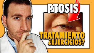 🟨 ¿Cómo CURAR la PTOSIS PALPEBRAL o párpado caído [upl. by Sokcin]