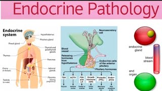 Endocrine Pathoma 5  Endocrine Pancreas Diabetes Type I amp II Pancreatic Tumors [upl. by Ehrlich]