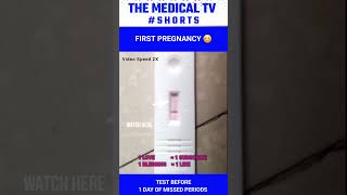 What does Faint line on UPT pregnancy test means  shorts [upl. by Severin19]