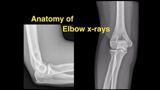 Anatomy of Elbow Xrays [upl. by Drud439]