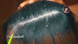 Dandruff Removal Long Hair Guys 174 [upl. by Kellia728]