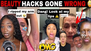 MERCY😱 BEAUTY HACKS GONE WRONG COSMETIC TRAUMA DIY BEAUTY FAILS  TIK TOK COMP [upl. by Chemash]