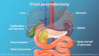 Pancreatic Surgery Benefits Risks and Relevant Anatomy [upl. by Tien]