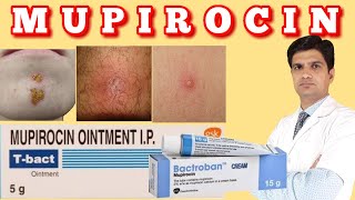 T bact ointment  Bactroban ointment  Mupirocin ointment uses side effects how to apply [upl. by Sanfourd]