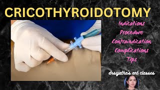 205cricothyroidotomy cricothyrotomy procedure airway emergency stridor [upl. by Quartis]