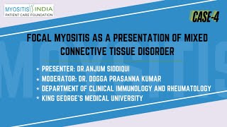 CASE 4 Focal Myositis as a presentation of Mixed Connective Tissue Disorder Dr Anjum Siddiqui [upl. by Dnaltiak654]