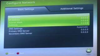 How To Connect Your Xbox 360 Live [upl. by Oilicec327]