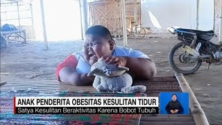 Kasihan Anak Penderita Obesitas Ini Kesulitan Tidur [upl. by Cleti]