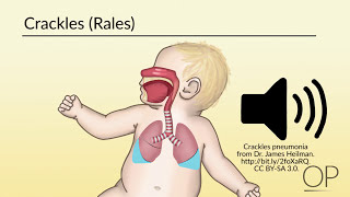 Respiratory Assessment by B Leary L DelSignore  OPENPediatrics [upl. by Reiss621]