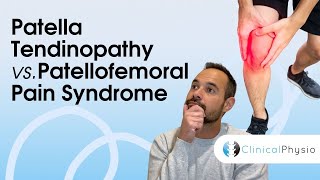 Patella Tendinopathy vs Patellofemoral Pain Syndrome  Expert Physio Guide [upl. by Peltier]