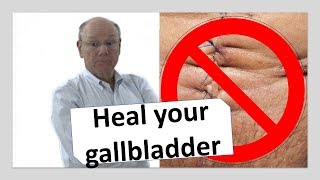 Heal your gallbladder naturally  NOW [upl. by Eustis991]