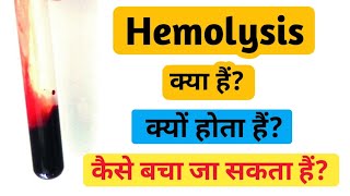 What is hemolysis  Hemolysis in hindi [upl. by Harl210]