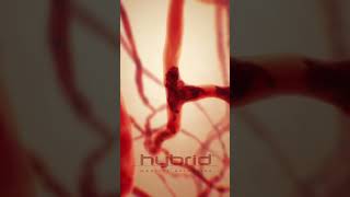 Sickle cell disease animation  sicklecelldisease SickleCellAnemia hemolysis medicalanimation [upl. by Norraj]