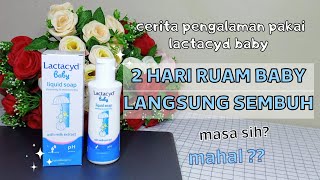 REVIEW LACTACYD BABY ATASI RUAM PADA KULIT BAYI [upl. by Amaso]