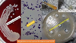 Staphylococcus aureus golden yellow colonies Gram stain Coagulase test Growth on MSA and AST [upl. by Hinkel]