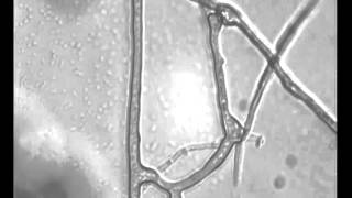 Anastomosis in mycorrhizal fungi [upl. by Nordek]