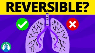 Reversible Airway Obstruction TMC Practice Question  Respiratory Therapy Zone [upl. by Rostand]