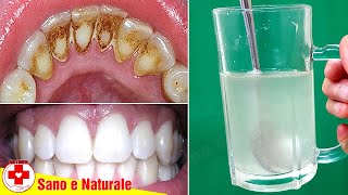 Rimuovere Placca Dentale E Tartaro Dai Denti Rapidamente Solo Con Questi 3 Ingredienti Naturali [upl. by Gilpin]