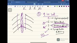 Medullary Syndrome Neurology04 FCPS Part01 Batch Whats App 01878342090 [upl. by Safoelc]