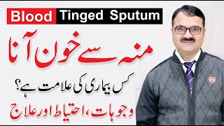 Blood Tinged Sputum  Moun se khoon ana  Khoon Thukna  Causes By Dr Tariq Ali Sheikh [upl. by Fredra]